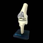 Bone Models™ 390301 Bone Shade Knee Model with Generic Implant, Front View