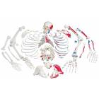 Disarticulated Full Skeleton with 3 Part Skull & Painted Muscles