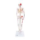 Mini Skeleton with Painted Muscles on Pelvic Mounted Base