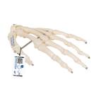 3B Scientific A40 Human Hand Skeleton Model, Wire Mounted