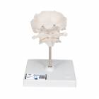 Atlas and Axis with Occipital Plate on Stand - 3B Smart Anatomy