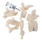 3B Scientific A75-1 Five Vertebrae Model - 3B Smart Anatomy