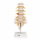 Flexible Lumbar Vertebral Column With Herniated Disc