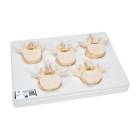Set of 5 BONElike Lumbar Vertebrae - 3B Smart Anatomy