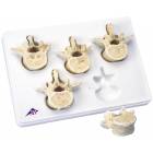 Set of 5 BONElike Lumbar Vertebrae