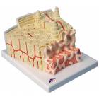 MICROanatomy Bone Structure Model - Enlarged 80 Times