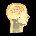 RSD Anthropomorphic Half Angiographic Head Phantom with Step Wedge