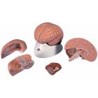 Brain Model 4-Part