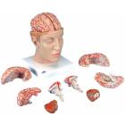 Head with Brain Model