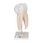 Upper Triple-Root Molar 3-Part