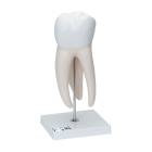 3B Scientific D15 Giant Molar with Dental Cavities 5-Part, 15 Times Life-Size - 3B Smart Anatomy
