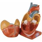 Giant Heart with Pericardium and Diaphragm