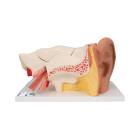 Ear Model 6-Part 3 Times Life-Size