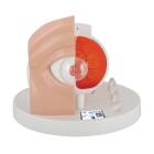 3B Scientific F17 Pathological Eye Model - 3B Smart Anatomy