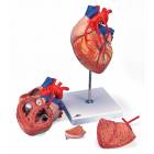 Heart Model with Bypass 2 Times Life-Size 4-Part