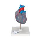 3B Scientific G08-3 Classic Heart Model with Conducting System 2-Part - 3B Smart Anatomy