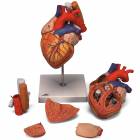 Heart Model with Esophagus and Trachea 2 Times Life-Size 5-Part