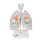 3B Scientific G23-1 Larynx Model with CT Bronchial Tree and Transparent Lungs - 3B Smart Anatomy