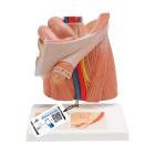 3B Scientific H13 Inguinal Hernia Model - 3B Smart Anatomy
