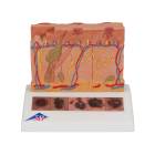 3B Scientific J15 Skin Cancer Model - Enlarged 8 Times, 3B Smart Anatomy