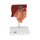 3B Scientific K26 Gallstone Model
