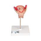 3B Scientific L10-2 Second Month Embryo Model