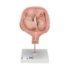 5th Month Twin Fetus Model - Normal Position
