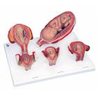 Standard Pregnancy Series - 5 Models