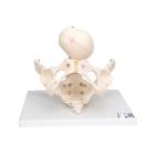 3B Scientific L30 Childbirth Demonstration Pelvis Model with Fetal Skull
