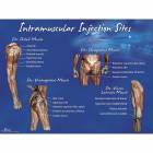 Life/form Intramuscular Injection Sites Set