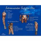 Life/form Intramuscular Injection Sites Chart