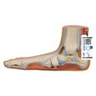 3B Scientific M31 Flat Foot (Pes Planus) Model - Light Skin Tone