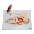 Nasco MG13920 Fetus Model with Placenta and Internal Organs Model, 11 Parts - Angle 1