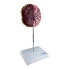 Nasco MG16212 Placenta Model - Angle 1