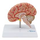 Nasco MG17228 Brain with Arteries Model - Angle 1
