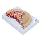 Nasco MG17229 Breast Cross-Section with Pathologies Model - Left Angle