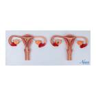 Nasco MG19471 Uterus with Fertilization Process Model - Angle 1