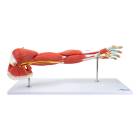 Nasco MG21152 Deluxe Muscles of the Arm Model, 7 Parts - Front View