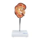 Nasco MG21415 Kidney Stone Model - Front View