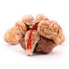 Nasco MG21717 Brain with Arteries Model, 9 Parts - Angle 1