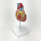 Nasco MG22274 Classic Heart with Ventricular Hypertrophy Model, Right Angle View