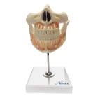 Nasco MG22594 Adult Dentition with Nerves and Roots Model - Front View