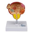 Nasco MG22730 Bladder and Prostate Diseases Model - Front View