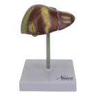 Nasco MG23415 Liver Section with Pathology Model, 2 Parts - Front View