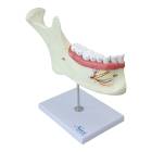 Nasco MG29512 Half Lower Jaw Model, 3x Enlarged, 6 Parts - Front View
