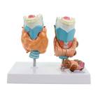Nasco MG29725 Thyroid with Pathology Model, 4 Parts