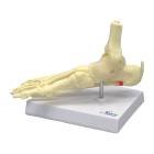 Nasco MG29758 Foot and Ankle with Plantar Fasciitis Model, Left Angle View
