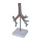 Nasco MG29764 Bronchial Tree Model, Left Angle View