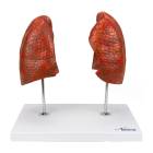 Nasco MG29786 Lung Model, 4-Part, Front View