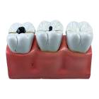 Nasco MG29837 Dental Morphology Model, 4x Enlarged, 7 Parts - Top View
